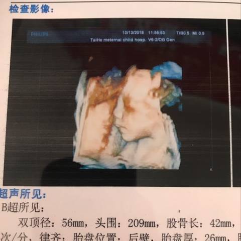 journal_insert_pic_1110882774