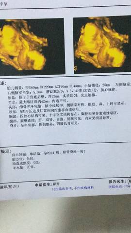 journal_insert_pic_1111139602