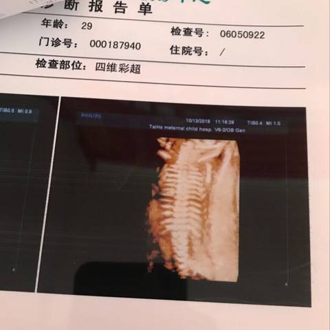 journal_insert_pic_1110882784