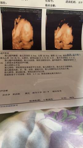 journal_insert_pic_1110775695