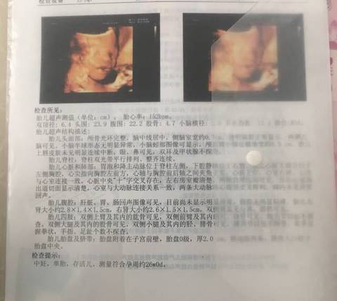 journal_insert_pic_1110974564
