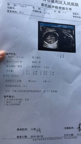 journal_insert_pic_1111265484