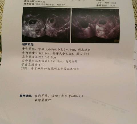 journal_insert_pic_1111796506