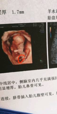 journal_insert_pic_1114136142