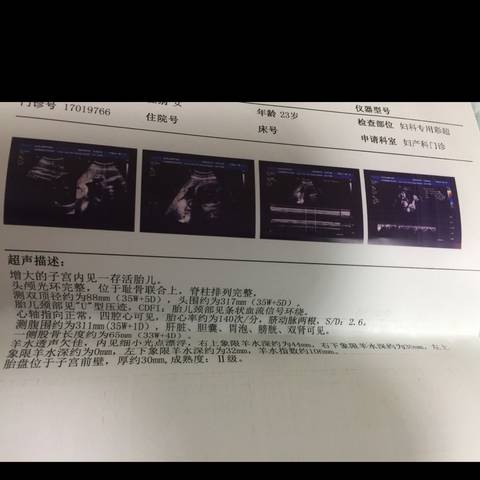 journal_insert_pic_1115866939