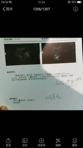 journal_insert_pic_1116605305