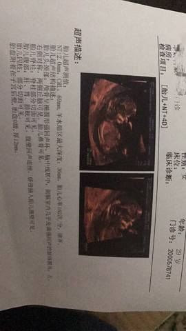 journal_insert_pic_1118836952