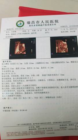 journal_insert_pic_1118762745
