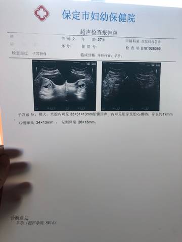 journal_insert_pic_1118597385