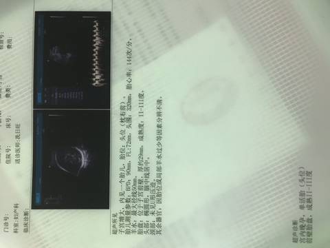 journal_insert_pic_1120456994