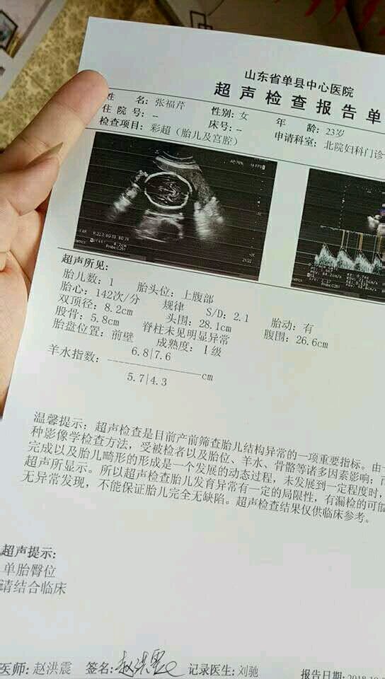 34周加5天了，跪求宝宝臀位转头位吧