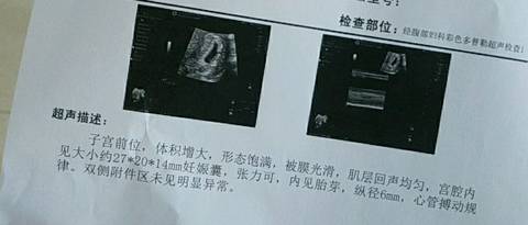 journal_insert_pic_1122432021