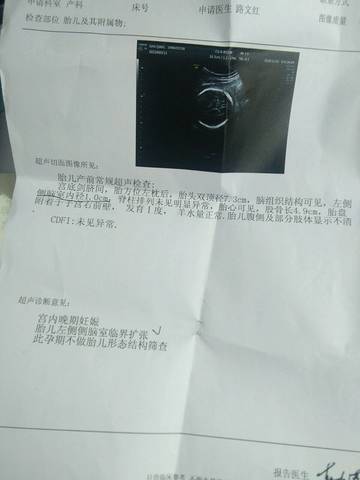 journal_insert_pic_1125376302
