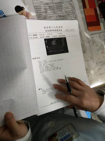 journal_insert_pic_1125307020