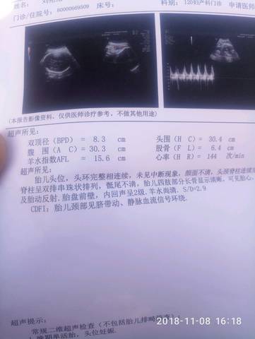 journal_insert_pic_1126367039