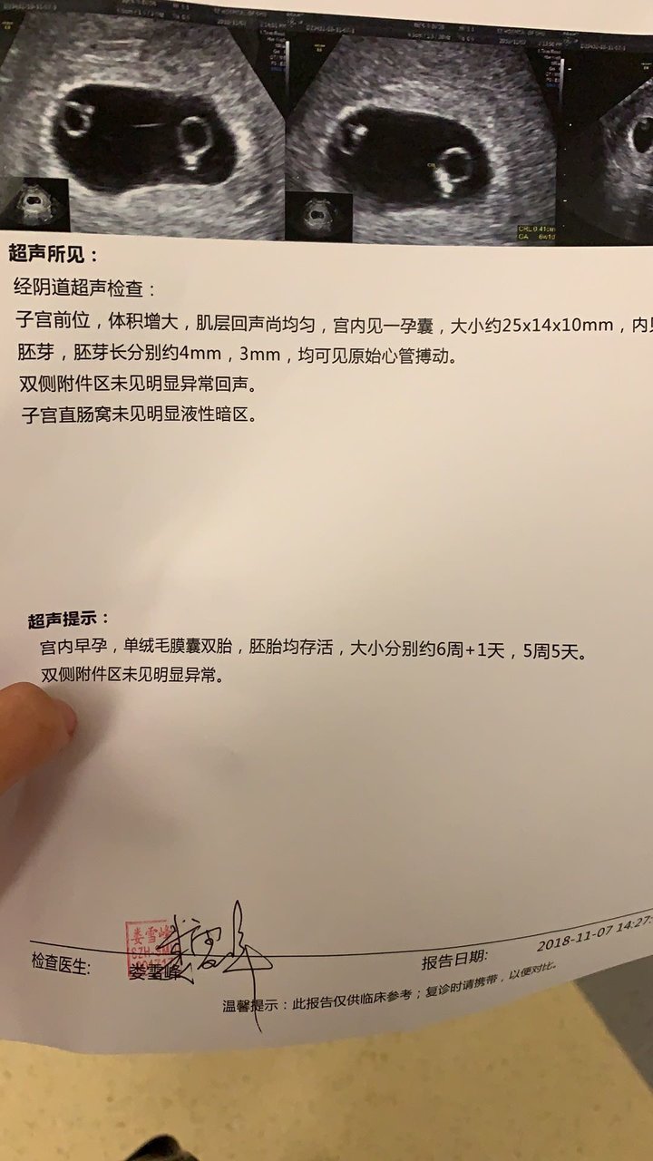 有没有人和我一样啊，单绒双胎，医生说生的话有风险，好害怕。