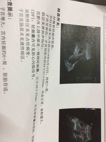 journal_insert_pic_1132445546