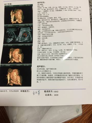journal_insert_pic_1131829333