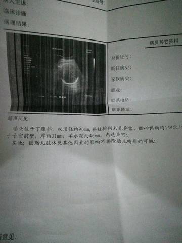 journal_insert_pic_1135257012