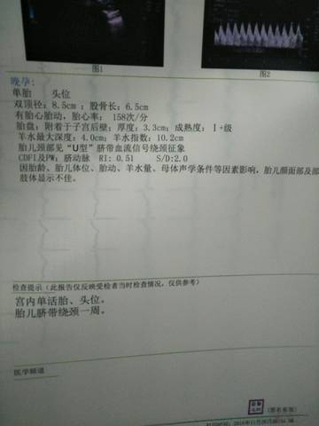 journal_insert_pic_1137403428
