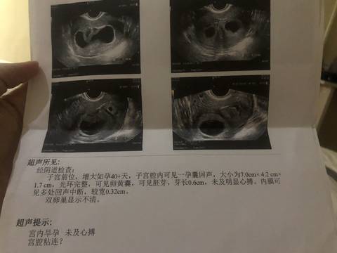 journal_insert_pic_1137316122