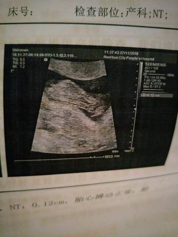 journal_insert_pic_1138557715