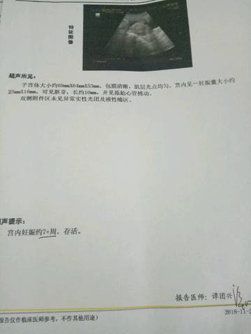 journal_insert_pic_1138277323