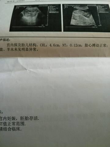 journal_insert_pic_1138557737