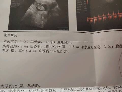 journal_insert_pic_1138848967