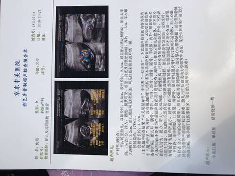 journal_insert_pic_1138657866