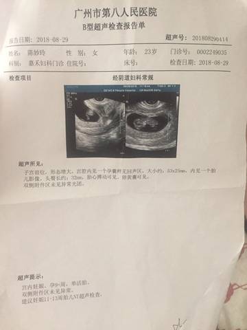 journal_insert_pic_1139219853