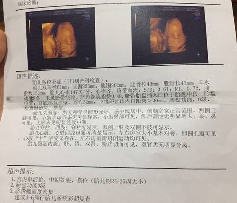 journal_insert_pic_1139450878