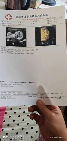 journal_insert_pic_1143906709