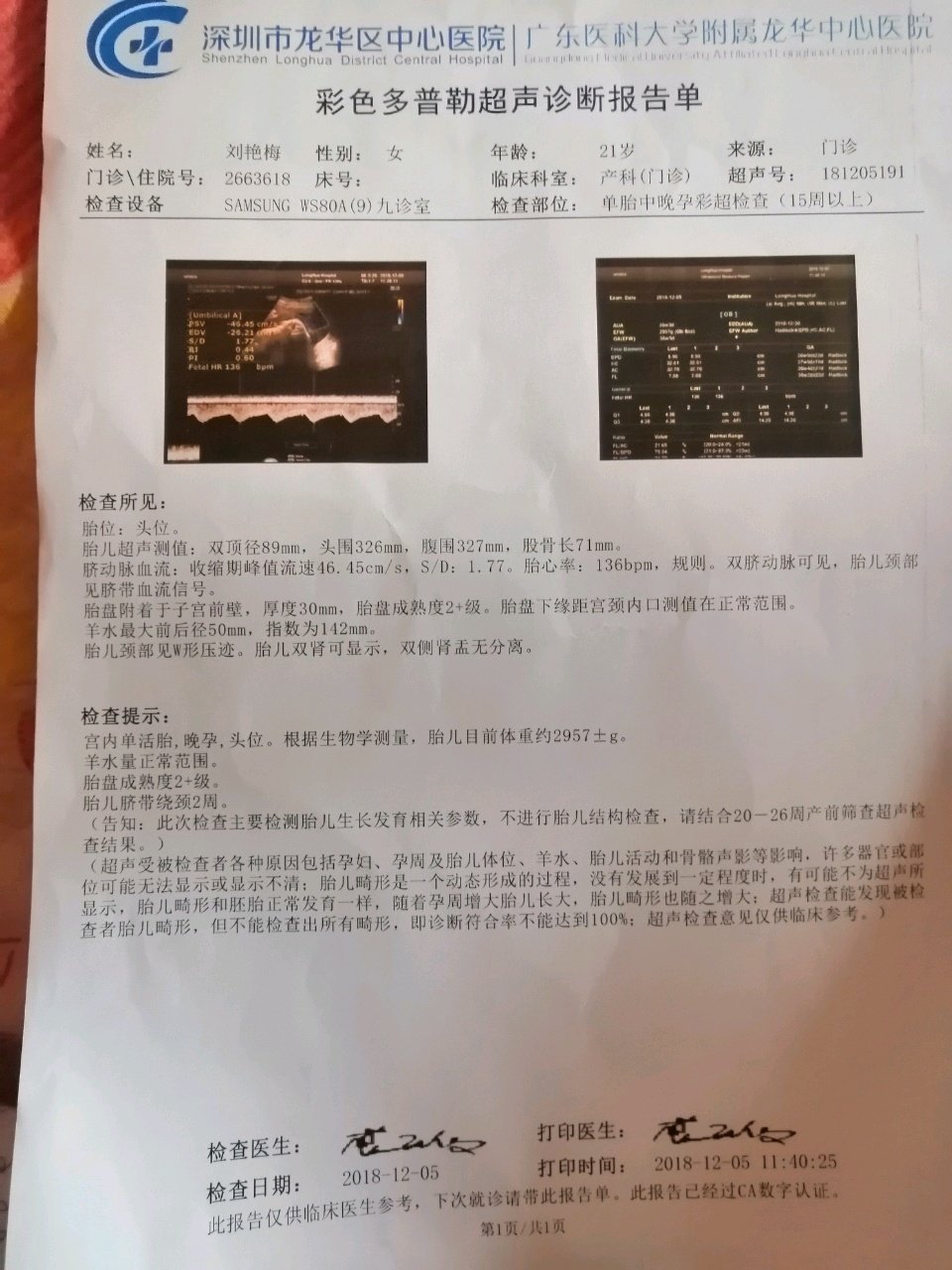 38+5求顺产无侧切，求发动，求见红