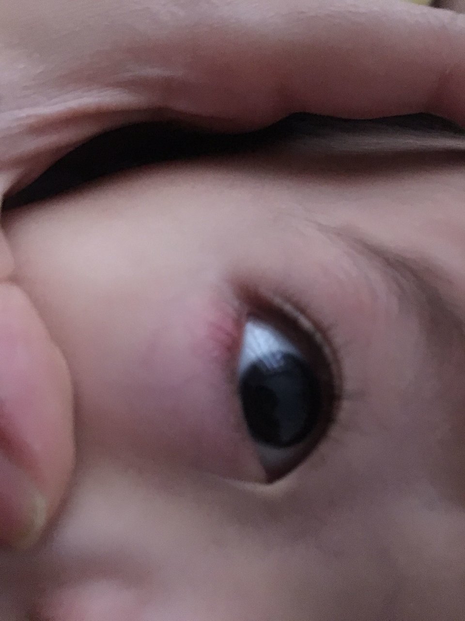 眼皮上红了，像是有个小疹子，这是什么啊？