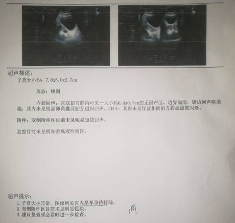 journal_insert_pic_1145834665