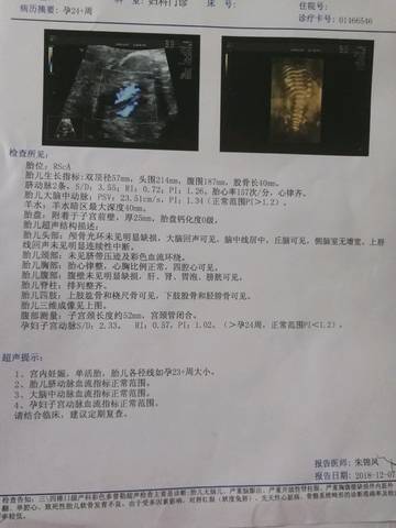 journal_insert_pic_1146981059