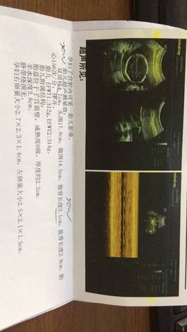 journal_insert_pic_1147137089