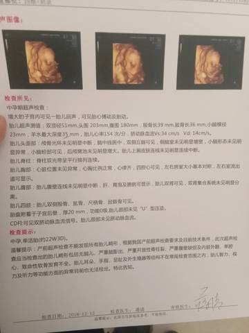 journal_insert_pic_1147617348