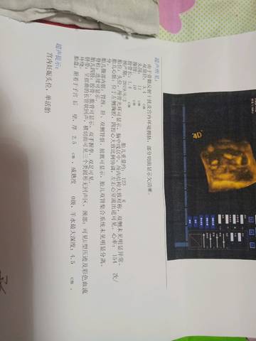 journal_insert_pic_1148325935
