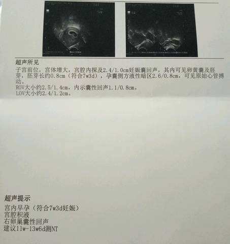 journal_insert_pic_1148646347