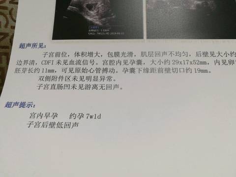 journal_insert_pic_1149043757