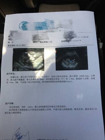 journal_insert_pic_1149702493
