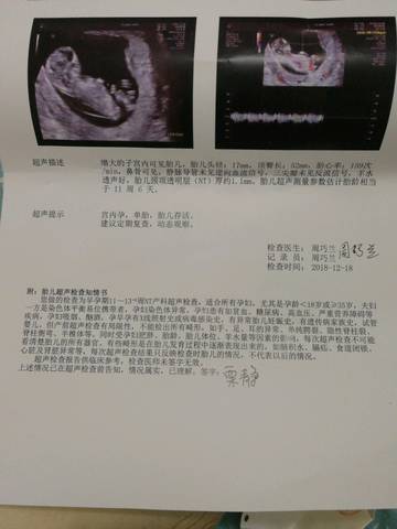 journal_insert_pic_1150371073