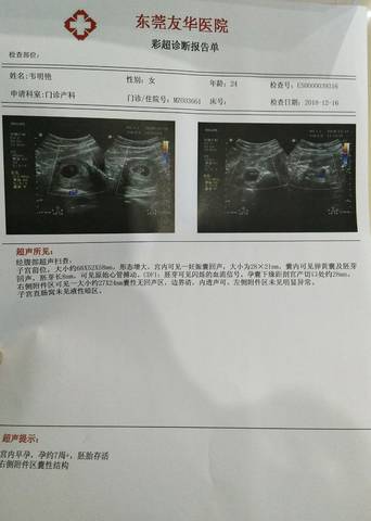 journal_insert_pic_1150374186