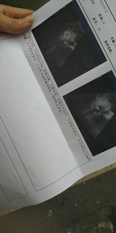 journal_insert_pic_1150937222