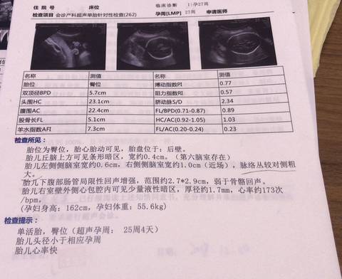 journal_insert_pic_1151712205