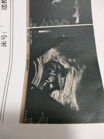 journal_insert_pic_1152658384