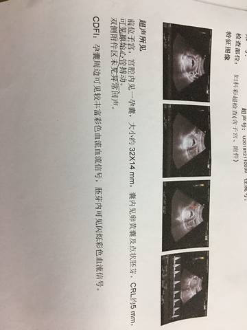 journal_insert_pic_1153166949