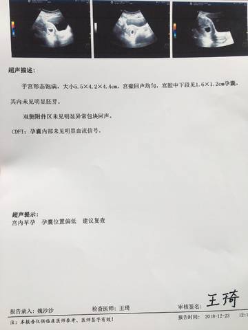 journal_insert_pic_1152992236